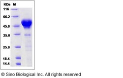 Sino Biological Recombinant Human Calumenin Protein (His Tag), Quantity: