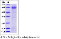 Sino Biological Human SUSD4 / Sushi domain-containing Protein 4 Protein