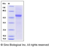 Sino Biological Recombinant Human ApoM Protein (hFc Tag), Quantity: Each