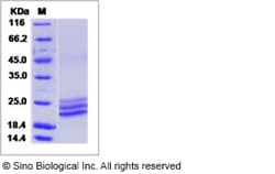 Sino Biological Recombinant Human ApoM Protein (His Tag), Quantity: Each