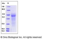 Sino Biological Recombinant Human GPR37 Protein (His Tag), Quantity: Each