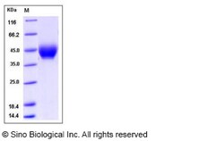 Sino Biological NRG1 Alpha Protein, Human, Recombinant (ECD, His Tag),