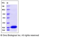 Sino Biological Recombinant Human TXNL4B Protein (His Tag), Quantity: Each