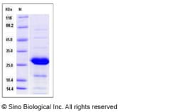 Sino Biological Recombinant Human PSPH Protein, Quantity: Each of 1
