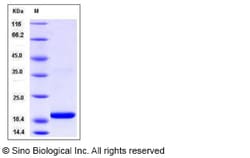 Sino Biological Human SELM / Selenoprotein M Protein (His Tag) 100ug, Quantity: