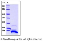 Sino Biological Recombinant Human SDF-1/CXCL12 Protein (isoform a, His