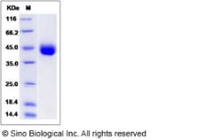Sino Biological Human IZUMO1 Protein (His Tag) 100ug, Quantity: Each of