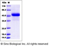 Sino Biological Recombinant Human Reticulocalbin 3/RCN3 Protein (His Tag),