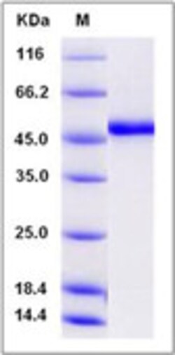 Sino Biological Recombinant Human ADAMTSL1 Protein (His Tag), Quantity: