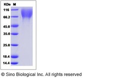 Sino Biological Recombinant Human LAMP2 Protein (His Tag), HPLC-verified,