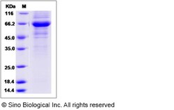 Sino Biological Recombinant Human FCMR/FAIM3 Protein (hFc Tag), Quantity:
