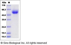Sino Biological Human SMPDL3A Protein (His Tag) 100ug, Quantity: Each of