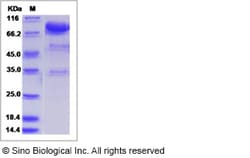 Sino Biological Recombinant Human UNC5H2/UNC5B Protein (ECD, hFc Tag),