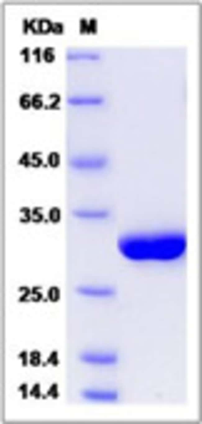 Sino Biological SERUM AMYLOID P PROTEIN 50UG, Quantity Each of 1