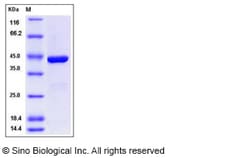 Sino Biological Recombinant Human IDO2 Protein (His Tag), Quantity: Each