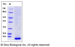 Sino Biological Recombinant Human CLPS Protein (His Tag), HPLC-verified,