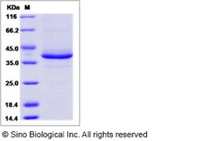 Sino Biological Human SPINK2 / HUSI-II Protein (Fc Tag) 100ug, Quantity: