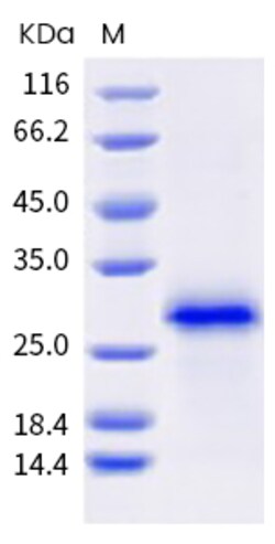 Human TNFRSF18 Protein 100ug (Sino Biological)