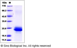 Sino Biological Human Serglycin / SRGN Protein (His Tag) 100ug, Quantity: