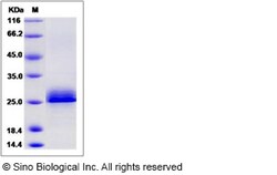 Sino Biological Recombinant Human Serglycin/SRGN Protein (His & Myc Tag),
