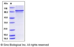 Sino Biological Recombinant Human PRAK/MAPKAPK5 Protein (His & GST Tag),
