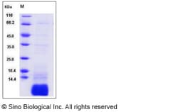 Sino Biological Human GNGT1 / GNG1 Protein (His Tag) 100ug, Quantity: Each