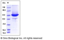 Sino Biological Human MSN / Moesin Protein (aa 1-346, His Tag) 100ug, Quantity: