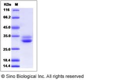 Sino Biological Recombinant Human EPDR1 Protein (His Tag), Quantity: Each