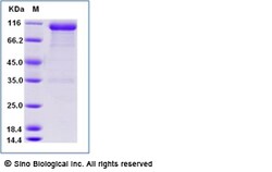 Sino Biological Human Angiopoietin 1 / ANG1 / ANGPT1 Protein (Fc Tag) 100ug,