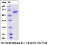 Sino Biological Recombinant Human Calcineurin A/PPP3CA Protein (His Tag),