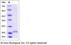 Sino Biological Recombinant Human Calcineurin B/PPP3R1 Protein (His Tag),