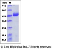 Sino Biological Human NAGA / Alpha-N-acetylgalactosaminidase Protein (His