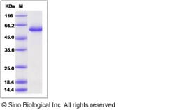 Sino Biological Human Galactolipase / PNLIPRP2 Protein (His Tag) 100ug,