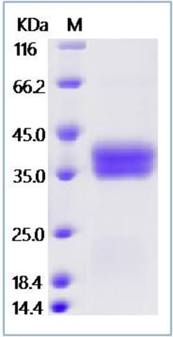 Sino Biological Recombinant Human Proteinase 3 Protein (203S/A, His Tag),