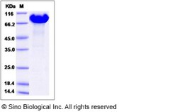 Sino Biological Human APLP1 / Amyloid-like protein 1 Protein (His Tag)