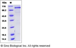 Sino Biological Human KDM1 / LSD1 Protein (His & GST Tag) 50ug, Quantity: