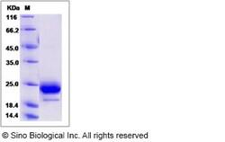 Sino Biological Recombinant Human TMED4 Protein (His Tag), Quantity: Each