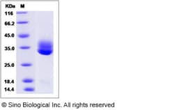 Sino Biological Recombinant Human CTRL Protein (His Tag), Quantity: Each
