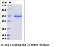 Sino Biological Human AGR3 / hAG-3 / BCMP11 Protein (Fc Tag) 100ug, Quantity: