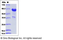 Sino Biological Recombinant Human PILR-alpha/FDF03 Protein (hFc Tag), HPLC-verified,