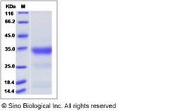 Sino Biological Recombinant Human PILR-alpha/FDF03 Protein, Quantity: Each