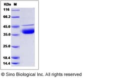 Sino Biological Recombinant Human DNase I Protein (His Tag), Quantity: