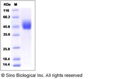 Sino Biological Recombinant Human DPEP2 Protein (hFc Tag), Quantity: Each