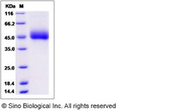 Sino Biological Recombinant Human DPEP2 Protein (His Tag), Quantity: Each