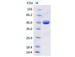 Sino Biological Protein Human IFNA2 1mg, Quantity: Each of 1