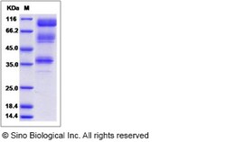 Sino Biological Recombinant Human IL-23 Receptor Protein (ECD, hFc Tag),