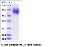 Sino Biological Recombinant Human IL-23 Receptor Protein (His Tag), HPLC-verified,