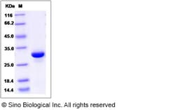 Sino Biological Recombinant Human UBASH3A Protein (aa 354-623, His Tag),