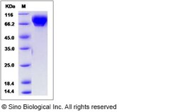 Sino Biological Recombinant Human SLITL2/VASN Protein (His Tag), Quantity: