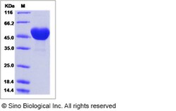 Sino Biological Recombinant Human Epiphycan Protein (His Tag), Quantity: